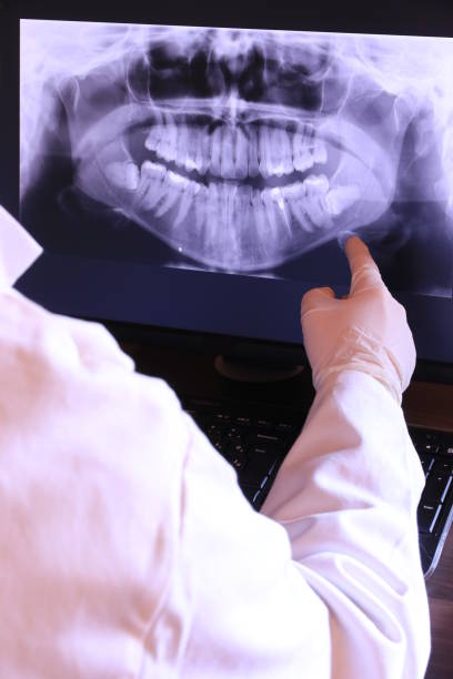 Best Emergency Treatment for Toothache in Rochester, NH